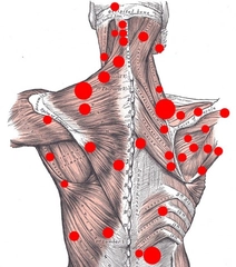 Sırt Kas Spazmı Belirtileri ve Tedavisi Sırt Kas Spazmı Belirtileri ve Tedavisi